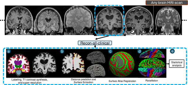 Figure 1 for Recon-all-clinical: Cortical surface reconstruction and analysis of heterogeneous clinical brain MRI