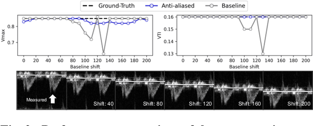 Figure 3 for A Unified Approach for Comprehensive Analysis of Various Spectral and Tissue Doppler Echocardiography