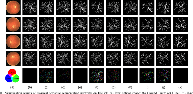 Figure 2 for PreCM: The Padding-based Rotation Equivariant Convolution Mode for Semantic Segmentation