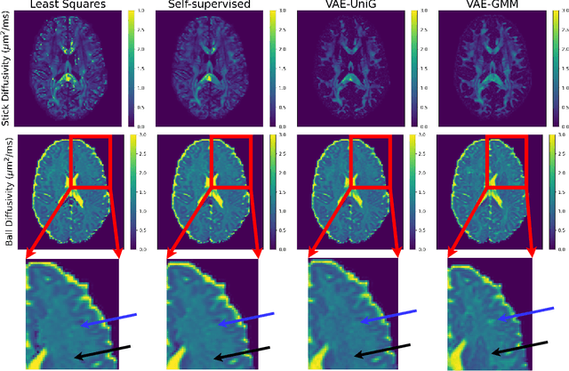 Figure 2 for MRI Parameter Mapping via Gaussian Mixture VAE: Breaking the Assumption of Independent Pixels