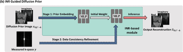 Figure 1 for Highly Accelerated MRI via Implicit Neural Representation Guided Posterior Sampling of Diffusion Models