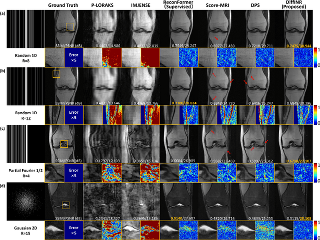 Figure 2 for Highly Accelerated MRI via Implicit Neural Representation Guided Posterior Sampling of Diffusion Models