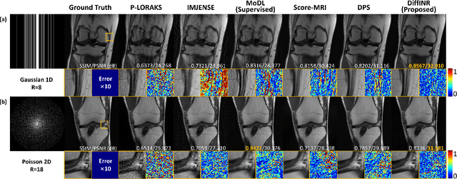 Figure 3 for Highly Accelerated MRI via Implicit Neural Representation Guided Posterior Sampling of Diffusion Models