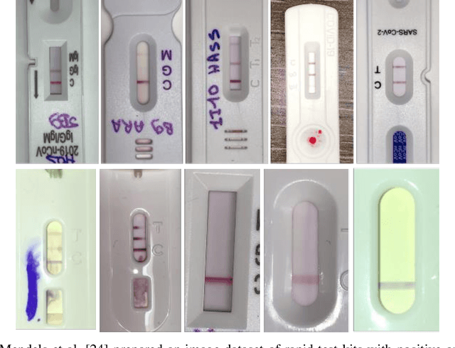 Figure 1 for AI-Driven Smartphone Solution for Digitizing Rapid Diagnostic Test Kits and Enhancing Accessibility for the Visually Impaired