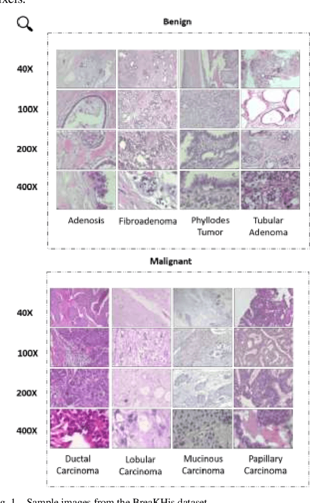 Figure 1 for Comparative Analysis of Deep Learning Architectures for Breast Cancer Diagnosis Using the BreaKHis Dataset