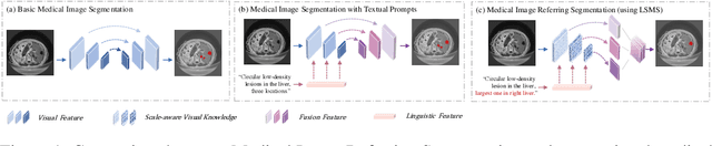 Figure 1 for LSMS: Language-guided Scale-aware MedSegmentor for Medical Image Referring Segmentation