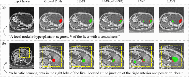 Figure 3 for LSMS: Language-guided Scale-aware MedSegmentor for Medical Image Referring Segmentation