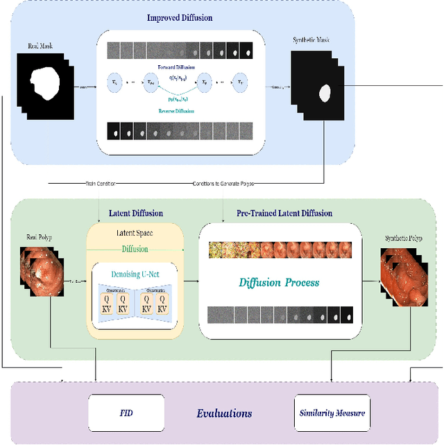 Figure 1 for Mask-conditioned latent diffusion for generating gastrointestinal polyp images