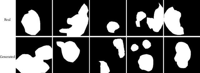 Figure 4 for Mask-conditioned latent diffusion for generating gastrointestinal polyp images