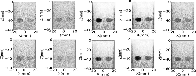 Figure 2 for Deep Ultrasound Denoising Using Diffusion Probabilistic Models