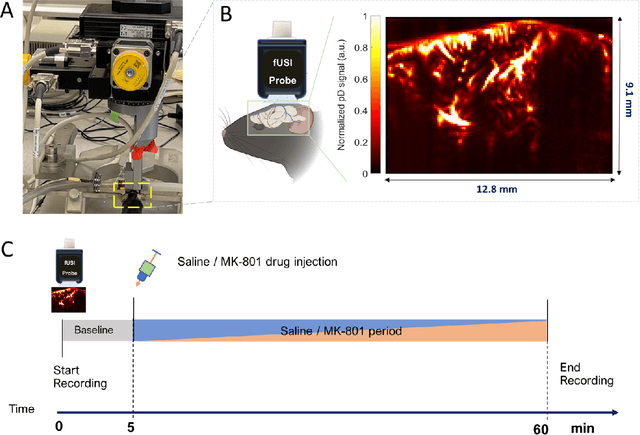 Figure 1 for Monitoring Drug-Induced Brain Activity Changes with Functional Ultrasound Imaging and Convolutional Neural Networks