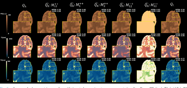 Figure 2 for Self-Supervised Weighted Image Guided Quantitative MRI Super-Resolution