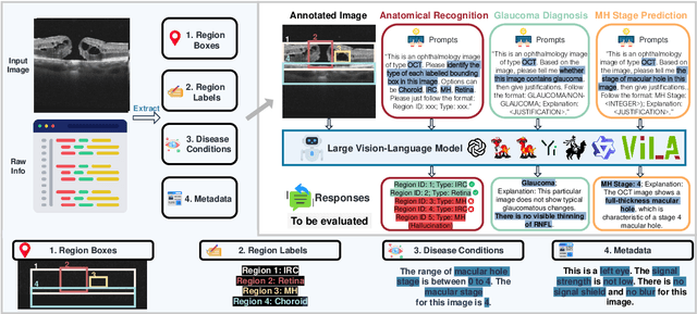 Figure 3 for LMOD: A Large Multimodal Ophthalmology Dataset and Benchmark for Large Vision-Language Models