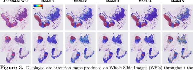 Figure 4 for CAMIL: Context-Aware Multiple Instance Learning for Whole Slide Image Classification