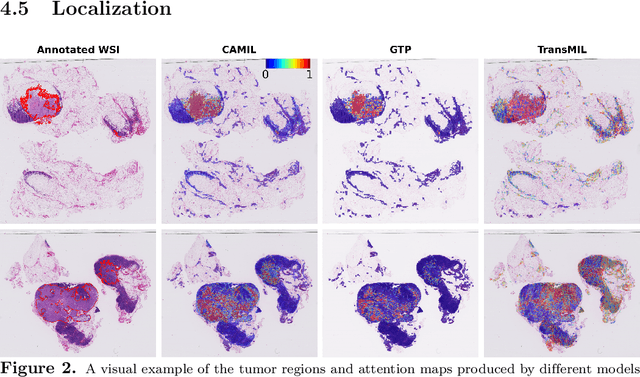 Figure 3 for CAMIL: Context-Aware Multiple Instance Learning for Whole Slide Image Classification