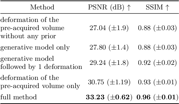 Figure 4 for GuidedRec: Guiding Ill-Posed Unsupervised Volumetric Recovery