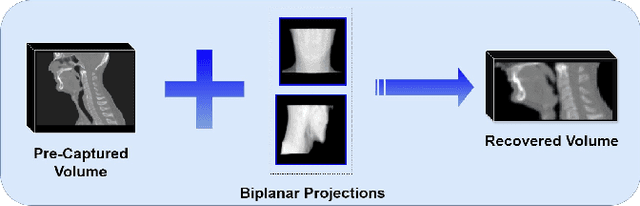 Figure 1 for GuidedRec: Guiding Ill-Posed Unsupervised Volumetric Recovery