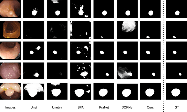 Figure 4 for FLDNet: A Foreground-Aware Network for Polyp Segmentation Leveraging Long-Distance Dependencies