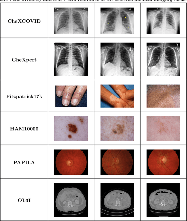 Figure 4 for FedMedICL: Towards Holistic Evaluation of Distribution Shifts in Federated Medical Imaging