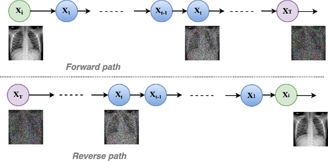 Figure 1 for Spot the fake lungs: Generating Synthetic Medical Images using Neural Diffusion Models