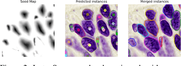 Figure 3 for InstanSeg: an embedding-based instance segmentation algorithm optimized for accurate, efficient and portable cell segmentation