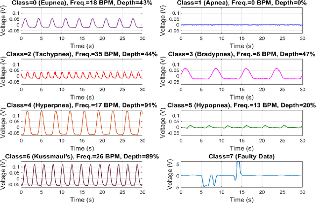 Figure 3 for 1D-CNN Optimization for Non-contact Respiration Pattern Classification