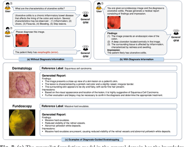 Figure 3 for MedDr: Diagnosis-Guided Bootstrapping for Large-Scale Medical Vision-Language Learning