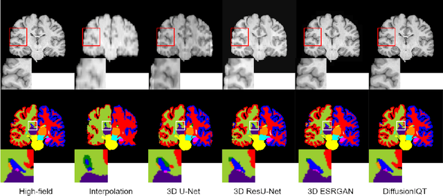 Figure 3 for A 3D Conditional Diffusion Model for Image Quality Transfer -- An Application to Low-Field MRI