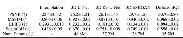 Figure 2 for A 3D Conditional Diffusion Model for Image Quality Transfer -- An Application to Low-Field MRI