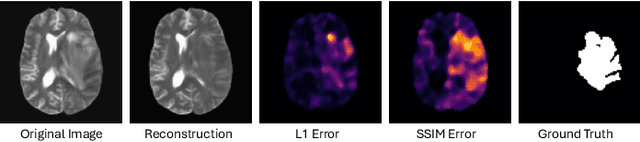 Figure 1 for Rethinking Medical Anomaly Detection in Brain MRI: An Image Quality Assessment Perspective