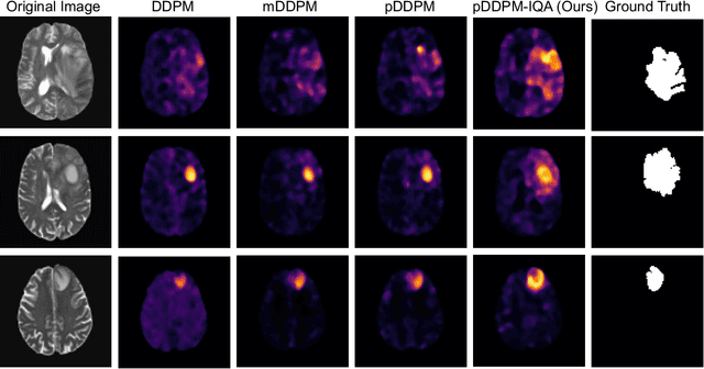 Figure 3 for Rethinking Medical Anomaly Detection in Brain MRI: An Image Quality Assessment Perspective