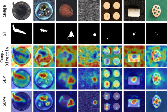 Figure 1 for CLIP-AD: A Language-Guided Staged Dual-Path Model for Zero-shot Anomaly Detection