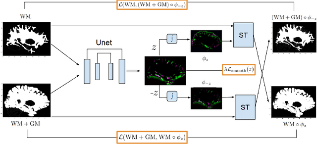 Figure 1 for CortexMorph: fast cortical thickness estimation via diffeomorphic registration using VoxelMorph