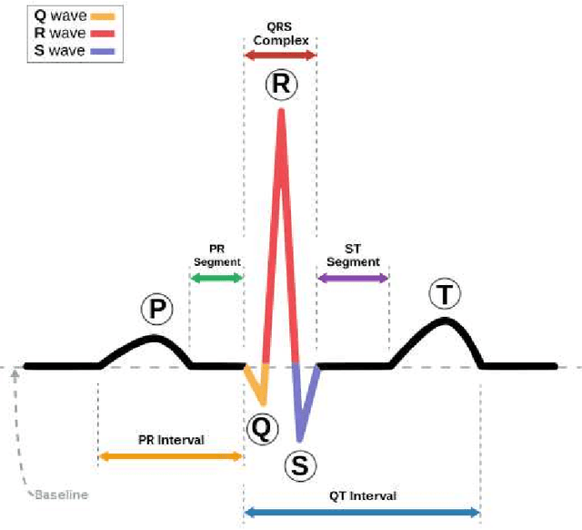 Figure 1 for Sparsity based morphological identification of heartbeats