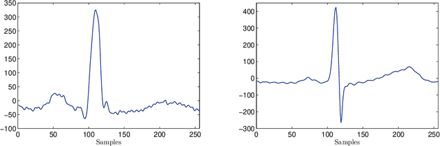 Figure 3 for Sparsity based morphological identification of heartbeats