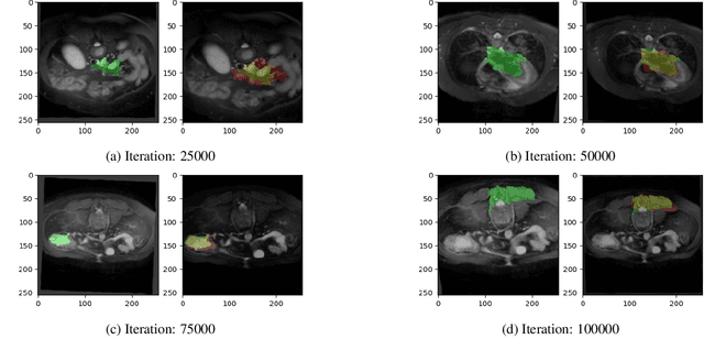 Figure 3 for Correlation Weighted Prototype-based Self-Supervised One-Shot Segmentation of Medical Images