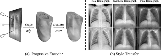 Figure 3 for XctDiff: Reconstruction of CT Images with Consistent Anatomical Structures from a Single Radiographic Projection Image