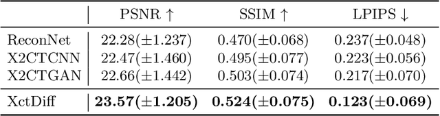Figure 2 for XctDiff: Reconstruction of CT Images with Consistent Anatomical Structures from a Single Radiographic Projection Image