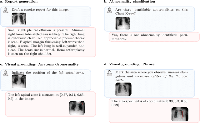 Figure 1 for RadVLM: A Multitask Conversational Vision-Language Model for Radiology