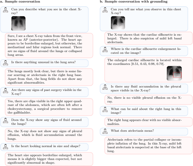 Figure 3 for RadVLM: A Multitask Conversational Vision-Language Model for Radiology