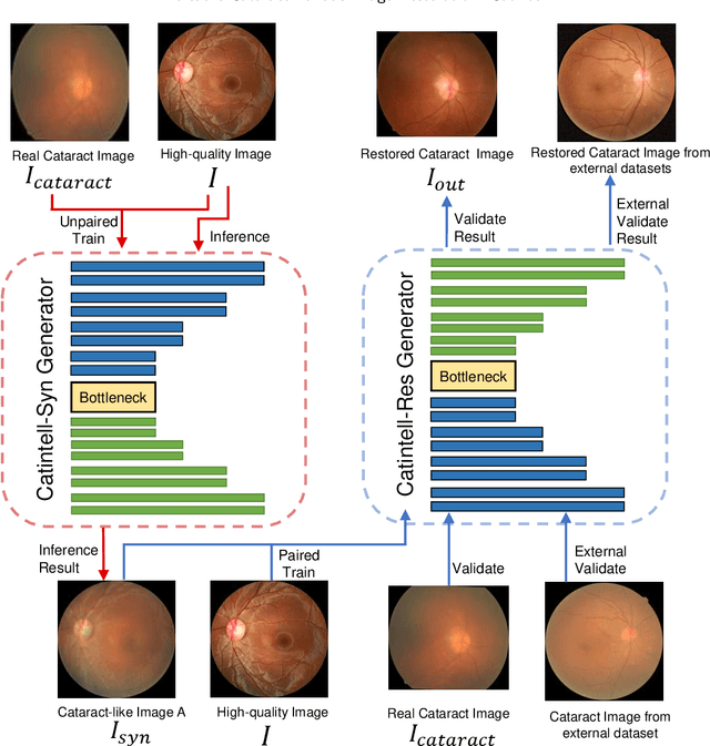 Figure 1 for Versatile Cataract Fundus Image Restoration Model Utilizing Unpaired Cataract and High-quality Images