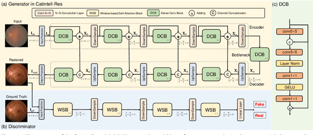 Figure 3 for Versatile Cataract Fundus Image Restoration Model Utilizing Unpaired Cataract and High-quality Images