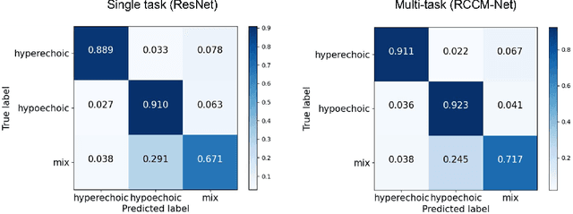 Figure 2 for A multi-task learning framework for carotid plaque segmentation and classification from ultrasound images