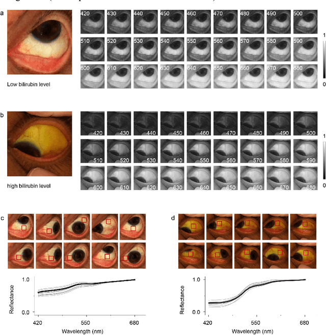 Figure 3 for Augmented smartphone bilirubinometer enabled by a mobile app that turns smartphone into multispectral imager