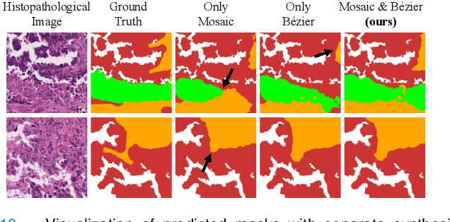 Figure 2 for HisynSeg: Weakly-Supervised Histopathological Image Segmentation via Image-Mixing Synthesis and Consistency Regularization