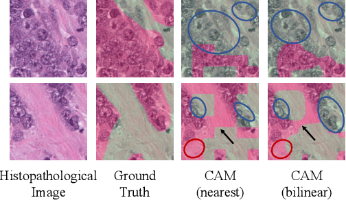 Figure 1 for HisynSeg: Weakly-Supervised Histopathological Image Segmentation via Image-Mixing Synthesis and Consistency Regularization