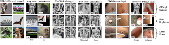 Figure 3 for SelfClean: A Self-Supervised Data Cleaning Strategy