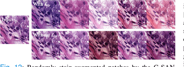 Figure 4 for A Laplacian Pyramid Based Generative H&E Stain Augmentation Network