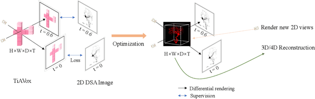 Figure 1 for TiAVox: Time-aware Attenuation Voxels for Sparse-view 4D DSA Reconstruction