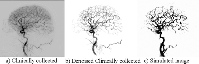 Figure 4 for TiAVox: Time-aware Attenuation Voxels for Sparse-view 4D DSA Reconstruction